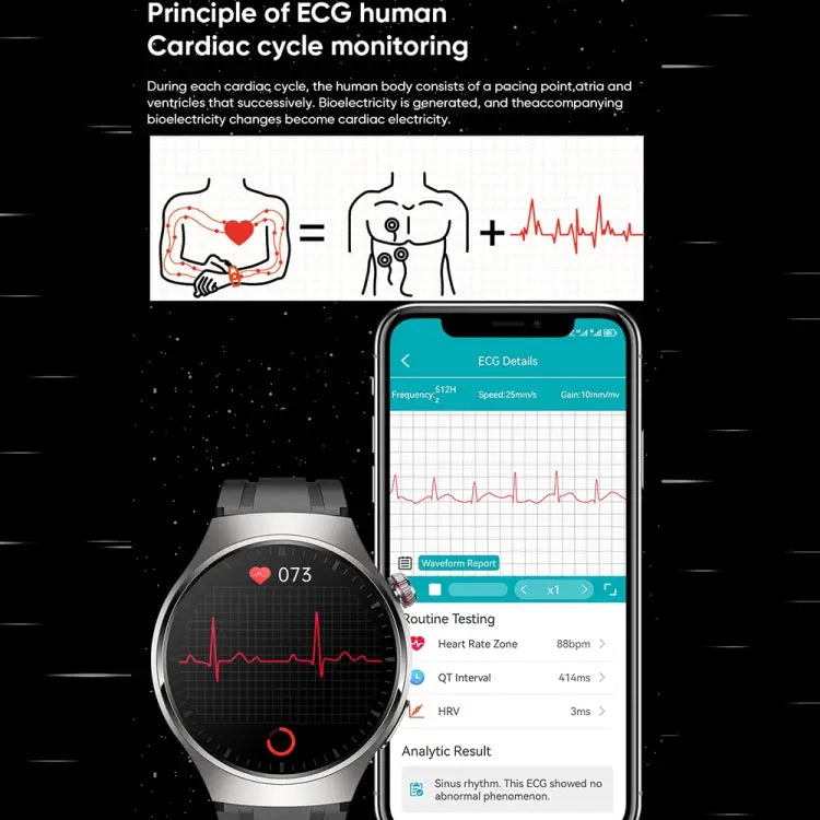 MT200 Smartwatch 1,43 inch AMOLED – Bluetooth bellen