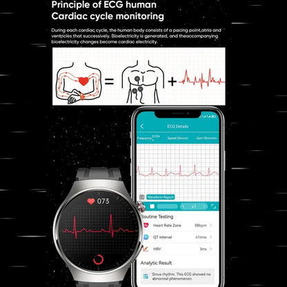 MT200 Smartwatch 1,43 inch AMOLED – Bluetooth bellen